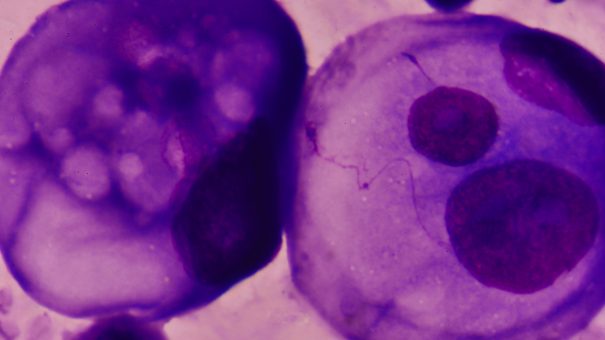 cancer_cells-605x340