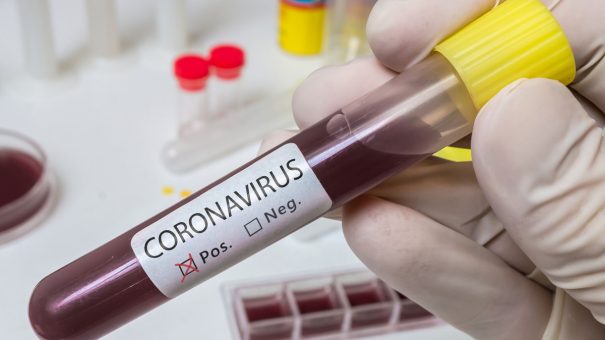 Charities-bankroll-coronavirus-drug-hunt-as-outbreak-hits-economies-605x340