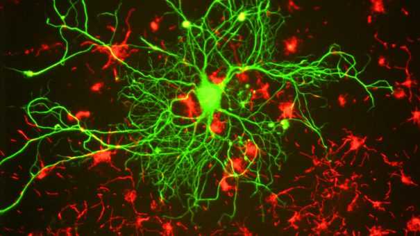 Neuron_in_tissue_culture-605x340